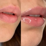 780-pirkti-DR-HEDISON-Melting-Lip-Oil-kaina-2 pirkti DR. HEDISON Melting Lip Oil kaina