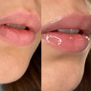 pirkti DR. HEDISON Melting Lip Oil kaina